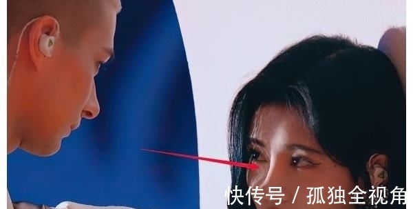 牙疼|被大球砸到牙疼，宋雨琦却慌张抚摸下巴，看清下巴形状我明白了