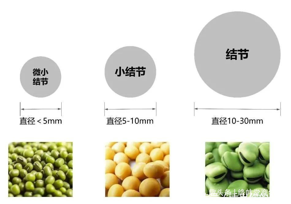  体检查出肺结节很小就不用管定期复查很重要