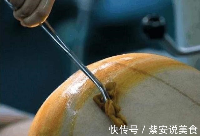 预产期|顺产虽然好,但是剖腹产的5个好处,是顺产做不到的,孕妇来看