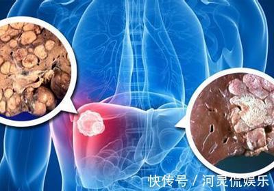 肝脏|肝毒终于碰到了“死对头” ,坚持吃一点,排净肝毒,肝病从此不来扰
