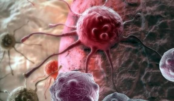 大部分|要满足4个条件，才能做到治愈癌症！可惜大部分人都挺不过去！