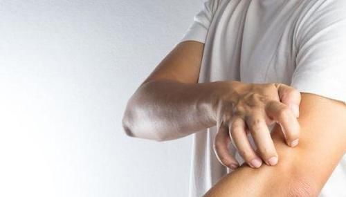 肝脏|误以为皮肤过敏,却查出肝硬化?身体两处发痒是咋回事呢?