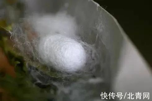 肠梗阻|腹痛20年，竟是肚里有个“大蚕茧”？！专家：反复出现这些症状要重视