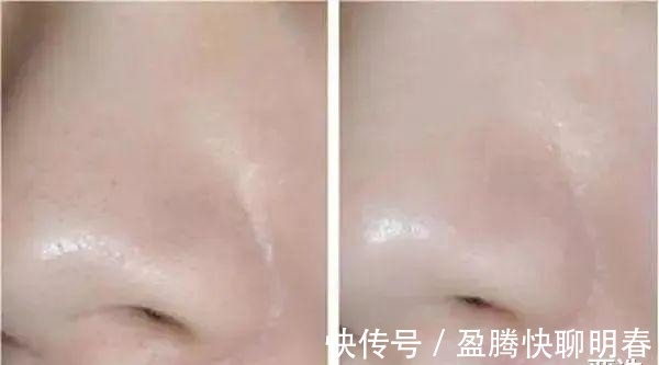 薇娅|能让李佳琦和薇娅看得上,这韩国去角质凝胶,实力真的很强大