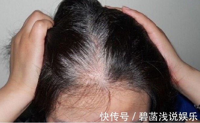 膀胱|白发与身体的关系，后悔现在才知道！附带防治的方法哦！快收藏