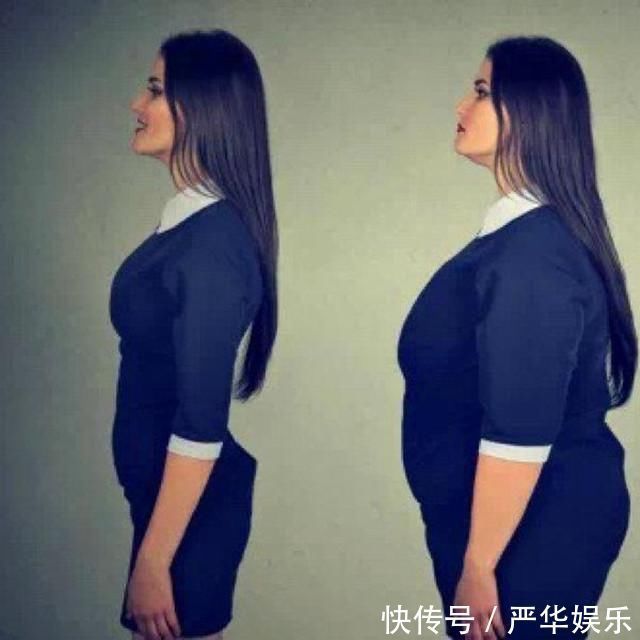 宝妈|产妇在剖腹产时提出“吸脂”要求,医生听后乐了肚子肉不归我管