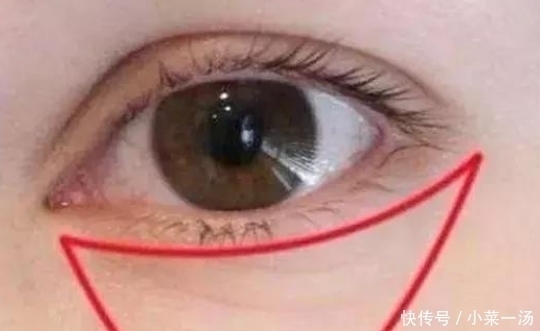 贫血|子宫健不健康,照照镜子就知道,脸上没3个表现,子宫还算干净!