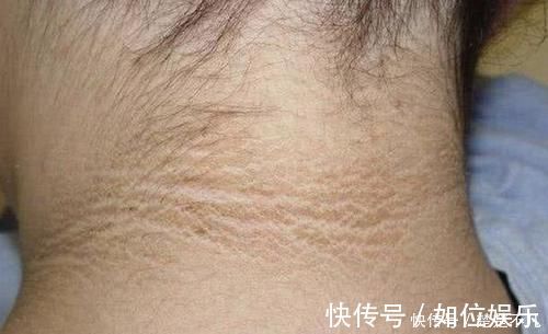 父母|6岁女儿脖颈发黑洗不掉,送医院检查,医生的解释令宝妈哭笑不得