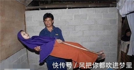 脂肪|女子手臂比大腿还粗,手臂上的脂肪切除掉还是会长出来