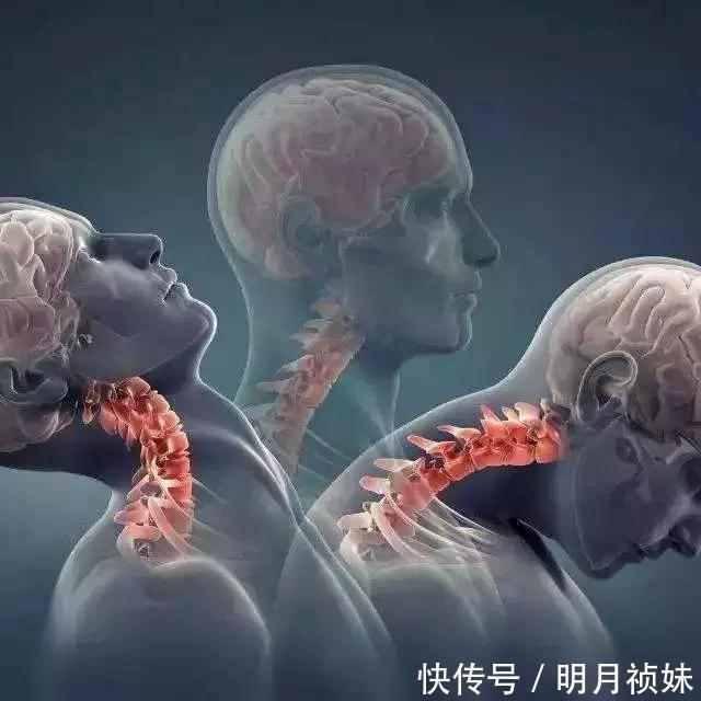 实用中医风湿病学|有一种树枝,是颈椎病“死敌”!这就是中国人的智慧