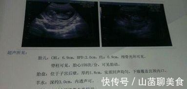 特征|孕检单上若有这3个“特征”,恭喜,或许是“小王子”要来了