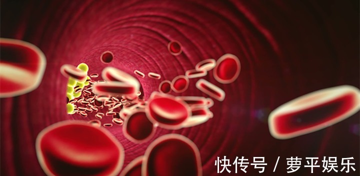 检查|引发心梗的高血脂,应该检查哪些指标