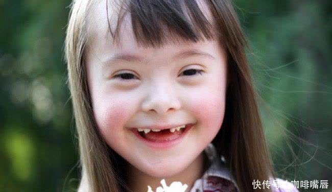 21三体综合症|外国宝妈不顾反对生下“唐氏宝宝”,网友坦言:都有一个共同点!