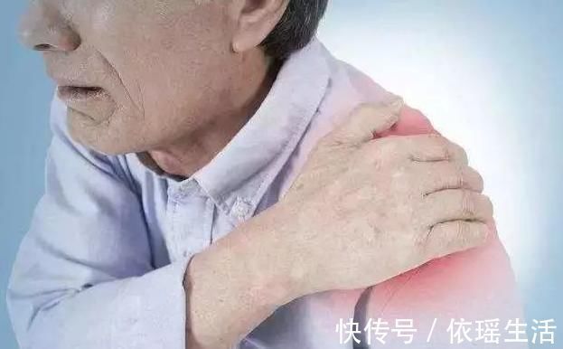 肩周炎|肩膀痛,莫瞎动八成以上不是肩周炎多数人还不清楚