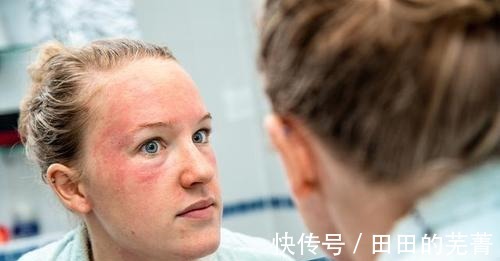 过敏|现在才知道,蚝油不能随便用,吃前谨记4不要,别再傻傻忽视了!