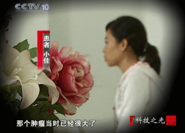 央视CCTV:癌症女孩六年多次大手术,免疫疗法助她重获新生