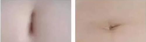 肚脐|你的五脏是否健康,不用去医院检查,按按肚脐就知道,早按早受益