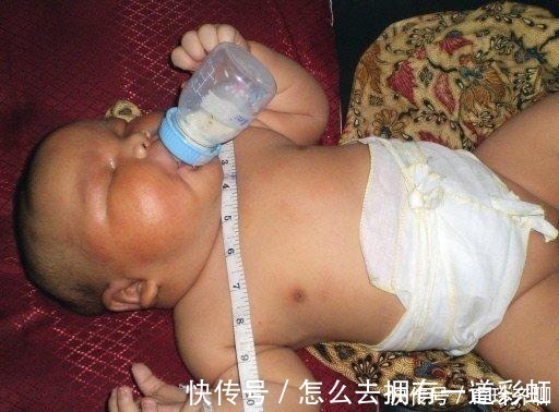 糖尿病|41岁高龄产妇竟产下17斤巨婴, 巨宝宝胃口更是大得让人咂舌