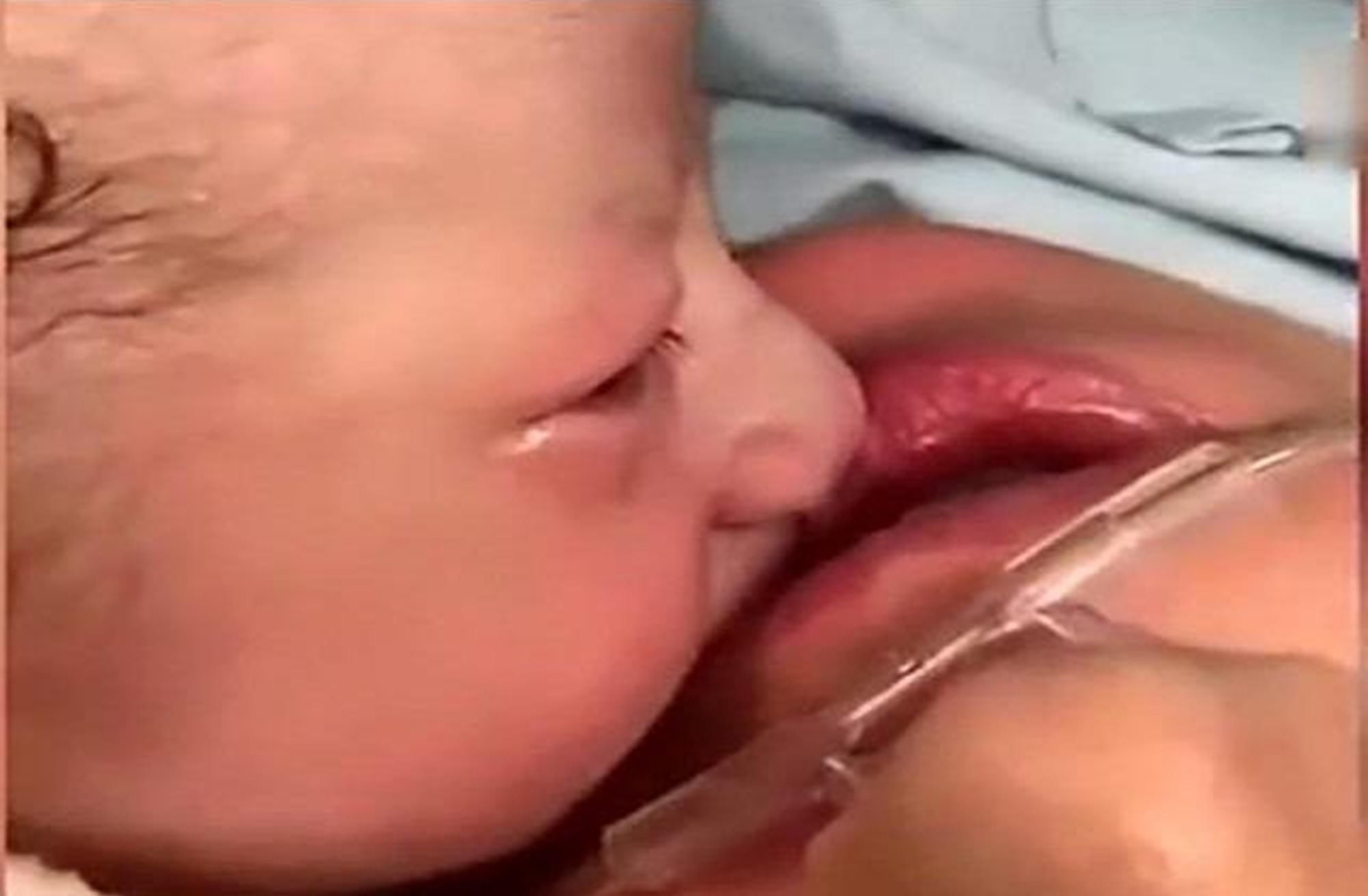 宝妈|90后宝妈产后昏迷，刚出生的宝宝轻吻妈妈，在场医生泛起泪花