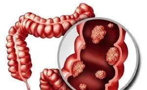 脾胃|4個(gè)老祖宗流傳已久的“土食”，補(bǔ)脾健脾調(diào)脾，養(yǎng)好脾胃百病難侵