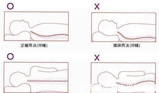 颈椎|预防颈椎病，睡眠姿势很关键，听听医怎么说