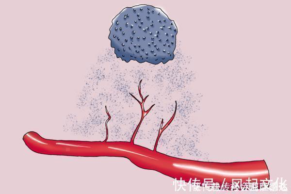 人大多|不容易得癌的人,都具备什么条件专家说出4个,你有没有