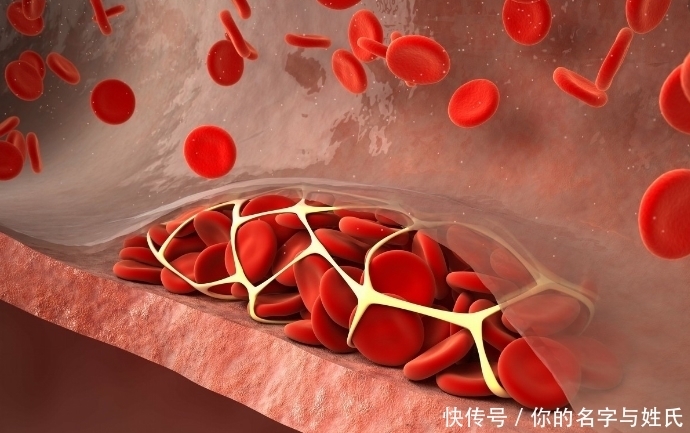 人体能自动清除血栓?若做好2点,可能有助于软化血管,血管健康