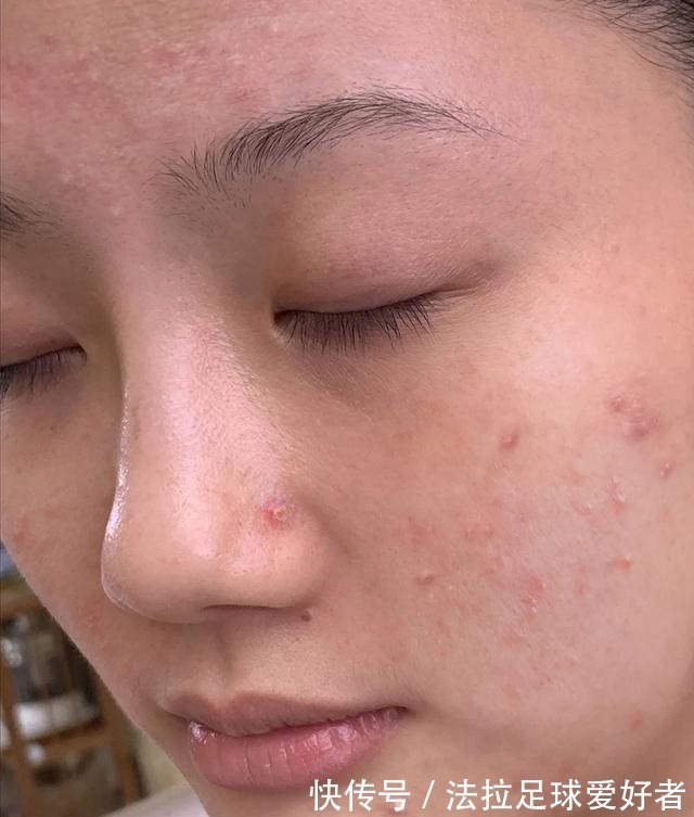 补水 脸上出现这4点“征兆”,说明你该好好护肤了,很多人都有!