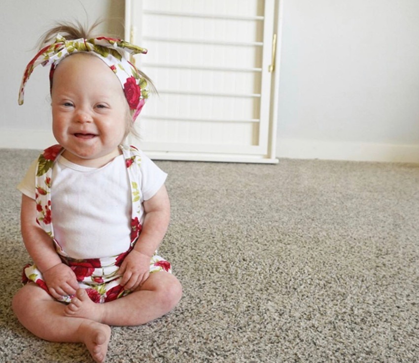 病症|产妇生下唐氏双胞胎姐妹,并没有放弃,网友唐宝都有一张国际脸