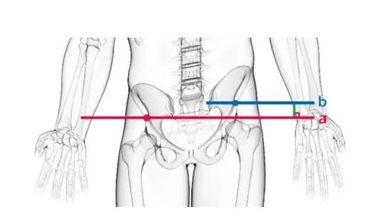 腰椎|七八岁的孩子腰椎像50岁一样，啥情况？