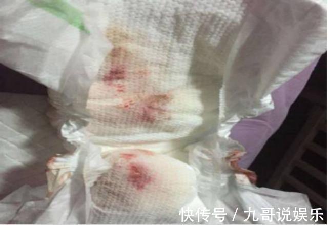 斗鸡眼|新生儿这些特殊生理现象,儿科医生孩子不是生病,不要乱花钱