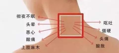 颈椎病|颈椎不好伤全身每天几分钟,告别颈椎病,从此不再“坐立不安”