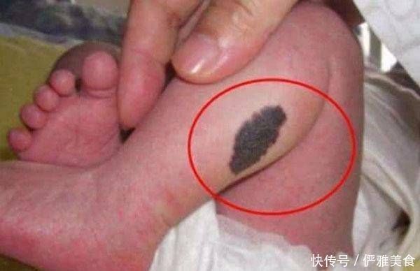 怀孕期间|怀孕期间，孕妇最好不要做这四件事，容易让宝宝将来有《胎记》