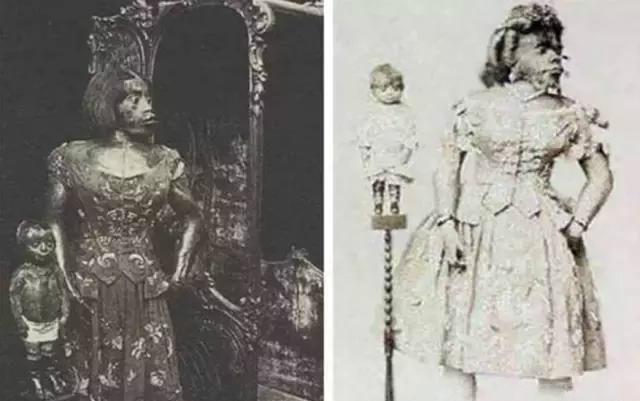 出生|史上最丑的女人,生前轰动一时,死后被丈夫制成标本展览154年