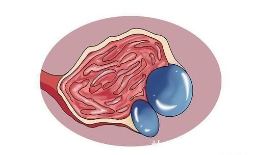 乳腺增生|医生提醒女性:体检时查出3种妇科病,其实不治也可以,别受骗了