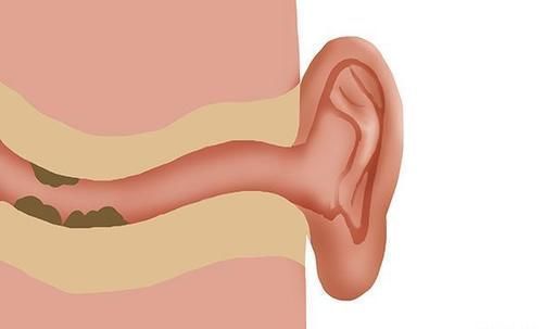 耳朵|为什么有的人耳朵会“流油”?是优势还是劣势?听听医生怎么说