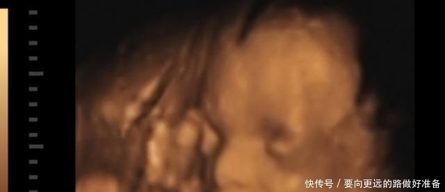 筛查|怀孕就像大冒险,这6道关卡准妈妈顺利闯过,基本上就能松口气了
