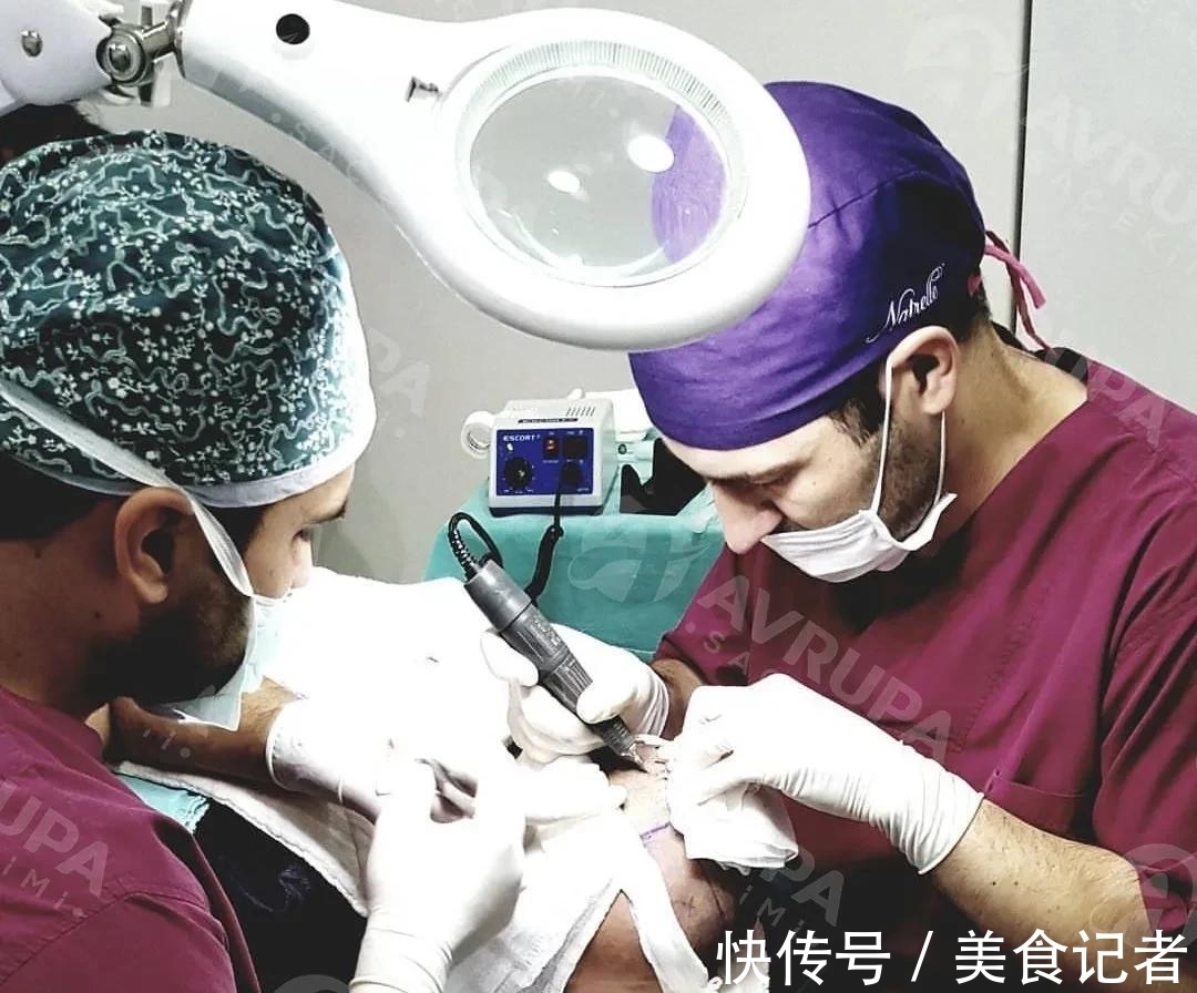 chris 每个月到底有多少人去土耳其植发？