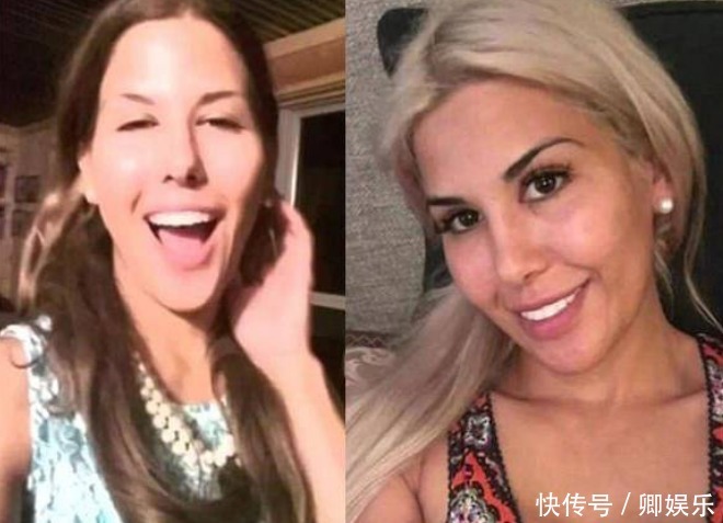 女子花重金整容，一年经历13次整容手术，整容前后判若两人！