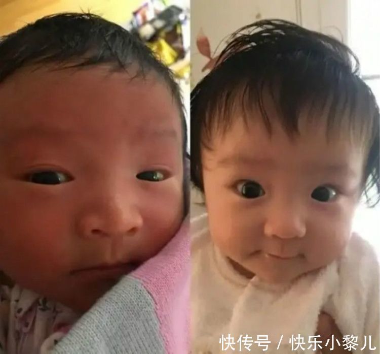 发红|''丑娃''出生遭全家嫌弃，护士却说漂亮，3个月后家人纷纷道谢