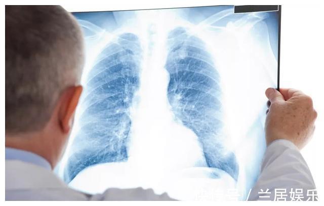 癌症|北大人民医院刘医生父亲查出了肺癌,希望放弃治疗,我没同意