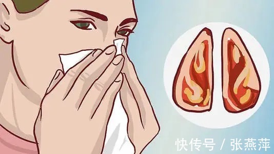 鼻炎|鼻炎是什么原因引起的