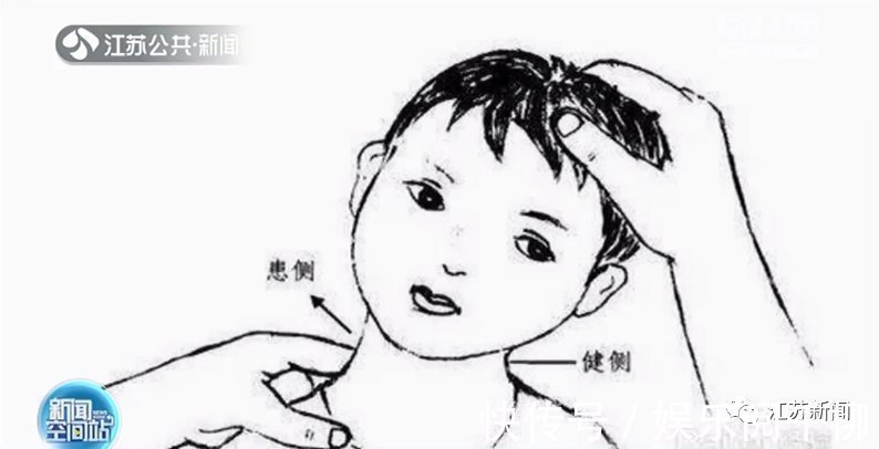 颈部|孩子总爱“歪头杀”卖萌?小心!可能是得了这种病