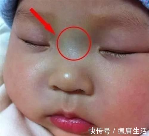 宝宝|“青筋过鼻梁,无事哭三场”这样的孩子脾气差、脾胃虚?别轻信