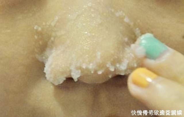 小苏打|常见的4种错误的除黑头方法,奉劝:不要再用了,越除黑头越多