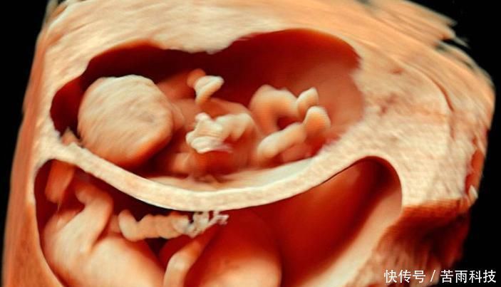胎儿|孕妈睡觉时,胎儿在干嘛?看到这个画面,小家伙真的太可爱了