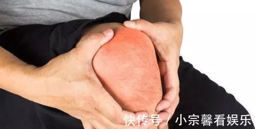 止痛|十腿九痛？百合+鸡蛋，缓肿痛消积液，半月板也能好！