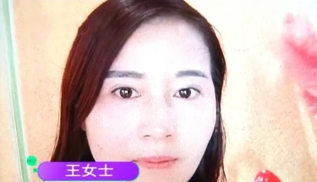 河南女子做免费整形后，怀念以前馒头脸，老公：笑起来像哭一样！