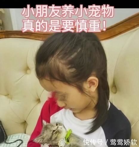 皮肤科|10天不到,小女孩头顶秃了,做这事千万慎重