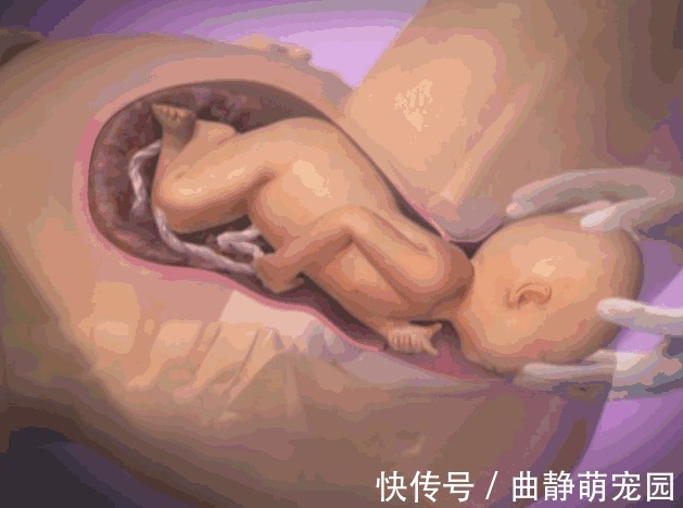 宫缩|胎儿分娩前在忙什么?忙着收拾东西出来呢,过来人的说法很真实